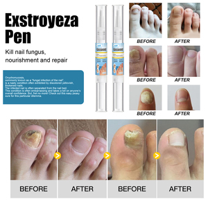 <span class=keywords><strong>SunM</strong></span> Cross-Border Onychomycosis Pen Care Liquid Nail Hydratant Repair Herbal Foot Use - Product Image 3