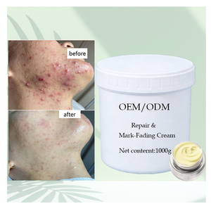 Crème anti-acné à base de plantes <span class=keywords><strong>en</strong></span> vrac KG - <span class=keywords><strong>Produit</strong></span> semi-fini - Matière première <span class=keywords><strong>en</strong></span> <span class=keywords><strong>gros</strong></span> pour l'atténuation des marques et des cicatrices d'acné - Product Image 1