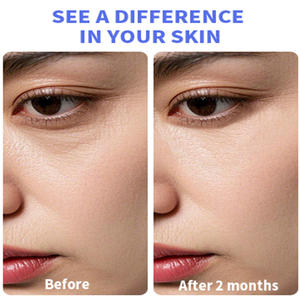 <span class=keywords><strong>Crema</strong></span> Contorno Occhi per Occhiaie, <span class=keywords><strong>Crema</strong></span> per Rimuovere le Occhiaie, <span class=keywords><strong>Crema</strong></span> Contorno Occhi Idratante - Product Image 6