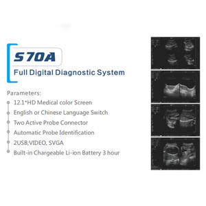 เครื่องอัลตราซาวนด์สัตวแพทย์แบบพกพา รุ่น 70A ระดับ Class II ได้รับการรับรองมาตรฐาน CE สำหรับการวินิจฉัยทั่วร่างกาย พร้อมอินเทอร์เฟซภาษาอังกฤษ - Product Image 5