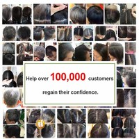 Shampoo colorant capillaire naturel, protège les fibres capillaires, protège contre la chute des cheveux, protège contre les démangeaisons du cuir chevelu, sans parabène