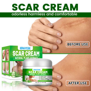 <span class=keywords><strong>Crema</strong></span> Efectiva para Eliminar Cicatrices, Blanqueadora, Reparadora de Cicatrices de Acné, Quemaduras y Cicatrices del <span class=keywords><strong>Embarazo</strong></span>, <span class=keywords><strong>Crema</strong></span> de <span class=keywords><strong>Aloe</strong></span> <span class=keywords><strong>Vera</strong></span> - Product Image 4