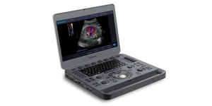 Offre Spéciale : Échographe Doppler Vétérinaire Portable Numérique Couleur Sonoscape X3V de Haute Qualité – Prix Compétitif - Product Image 2