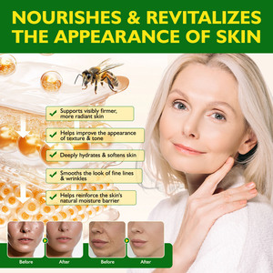 ELAIMEI <strong>Removes</strong> All Skin <strong>Warts</strong> Bee Venom <strong>Cream</strong> Skin Spot Smooths the Look of Fine Lines Skin Tag <strong>Removal</strong> Bee Venom <strong>Cream</strong> - Product Image 2
