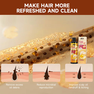 Set de Cuidado Capilar Vegano Nary de Marca Privada al por Mayor <span class=keywords><strong>con</strong></span> <span class=keywords><strong>Huevo</strong></span> y <span class=keywords><strong>Miel</strong></span> Orgánicos <span class=keywords><strong>para</strong></span> Reparación del Cabello Dañado, <span class=keywords><strong>para</strong></span> un Cabello Grueso y Voluminoso - Product Image 6