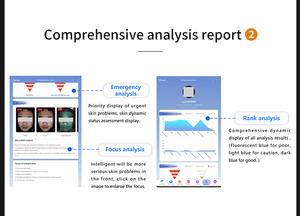 Équipement de beauté prêt à expédier, <span class=keywords><strong>scanner</strong></span> de peau intelligent à IA, 8 modes d'éclairage, analyse faciale <span class=keywords><strong>3D</strong></span> pour l'acné, les pigments, les pores, les rides - Product Image 3