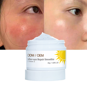 OEM Beauty Skin Care recupero a secco Gel vegano di Aloe Vera ripara la <span class=keywords><strong>crema</strong></span> per frullati <span class=keywords><strong>dopo</strong></span> la riparazione delle scottature solari - Product Image 1