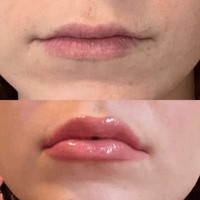 Huile à Lèvres Gloss Repulpante avec Logo Personnalisé pour Marque Privée, Repulpeur de Lèvres Maquillage Volumateur