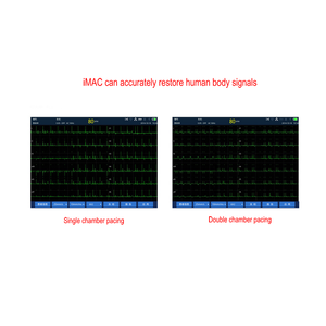 Électrocardiographe à écran tactile 12 fils 12 canaux EKG Machine <span class=keywords><strong>Zoncare</strong></span> IMAC120 <span class=keywords><strong>ECG</strong></span> Machine - Product Image 5