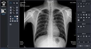 Apparecchio radiologico digitale ad alta frequenza per radiografia digitale DR per diagnosi radiologiche cliniche ospedaliere - Product Image 3