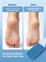 Lima de Pies Profesional con Superficie de Malla, Removedor de Callosidades y Piel Muerta, Herramienta de Pedicura Portátil para el Cuidado de los Pies