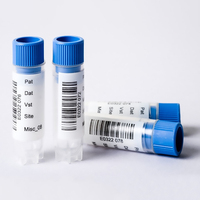 Impresión personalizada de fábrica, tubo de prueba de recolección de sangre médica, etiqueta adhesiva extraíble de Frozen, etiquetas de diseño personalizado para hospitales