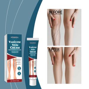 Crema Premium Natural de Marca Blanca para el Alivio de las Venas Varicosas, para una Mejor Circulación en las Piernas, Solución Empresarial - Product Image 2