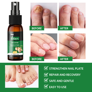 Marque Blanche 2025 Nouvelle Arrivée Spray Anti-<span class=keywords><strong>Mycose</strong></span> des Ongles 7 Jours Répare les Ongles et Cuticules Endommagés Produits de Soin 30ml MOOYAM Spray Ongles - Product Image 3