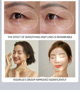 Dispositivo de Rejuvenecimiento Facial con Luz Roja y Azul, Herramienta Eléctrica para el Cuidado de la Piel, Masajeador Facial, Herramienta de Estiramiento Facial - Product Image 4