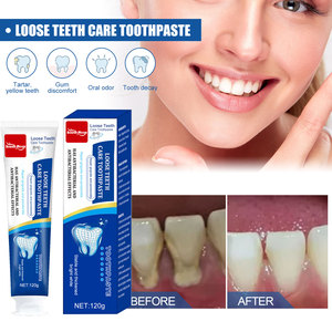 Dentifrice South Moon pour réparation rapide des caries, blanchiment des dents, élimination de la plaque dentaire, taches, caries, haleine fraîche, réparation des dents, produit de soin dentaire - Product Image 6