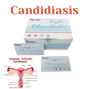 Prueba Rápida 2 en 1 para Clamidia Trachomatis/Gonorrea, Kit de Prueba Rápida para <span class=keywords><strong>Enfermedades</strong></span> de Transmisión Sexual - Product Image 5