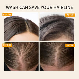 Champú de plantas naturales que contiene menta de romero, champú de <span class=keywords><strong>crecimiento</strong></span> rápido de pelo fuerte de hojas de ciprés, champú de control de Aceite hidratante - Product Image 6