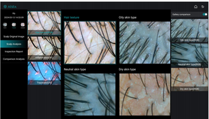 Macchina per Analisi del Cuoio Capelluto con Intelligenza Artificiale, Miglior Analizzatore Capillare con AI - Product Image 4