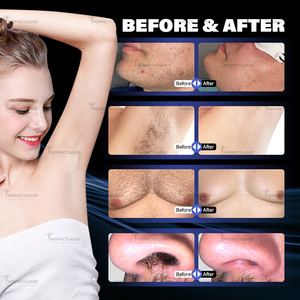 <span class=keywords><strong>Appareil</strong></span> d'épilation au laser à diode à 3 ondes Perfectlaser, embout facial de 8 mm, zones difficiles d'accès, <span class=keywords><strong>nez</strong></span>, <span class=keywords><strong>oreilles</strong></span>, sourcils, <span class=keywords><strong>appareil</strong></span> d'épilation des <span class=keywords><strong>poils</strong></span> - Product Image 5