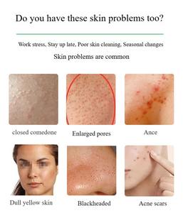 Incroyables aiguilles liquides microscopiques Hydra-Facial du salon de beauté recommandées - Product Image 5