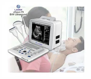 LANNX uRason P8 Anpassbares medizinisches diagnostisches Ultraschalls canner gerät 2D-Bild Ultraschall gerät ecografia porta til