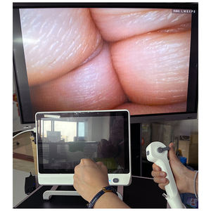 पोर्टेबल एंडोस्कोपिओ ऑपरेटिंग लार्ynगोस्कोप मानव या पशु पशु बिल्ली कुत्ते के लिए लचीला एंडोस्कोप - Product Image 3