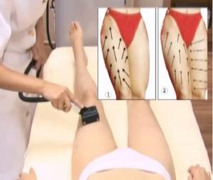 2025 nuova e di tendenza macchina a rullo a vuoto corpo scultura Lifting facciale per il collo massaggiatore di drenaggio linfatico attrezzature di bellezza - Product Image 5