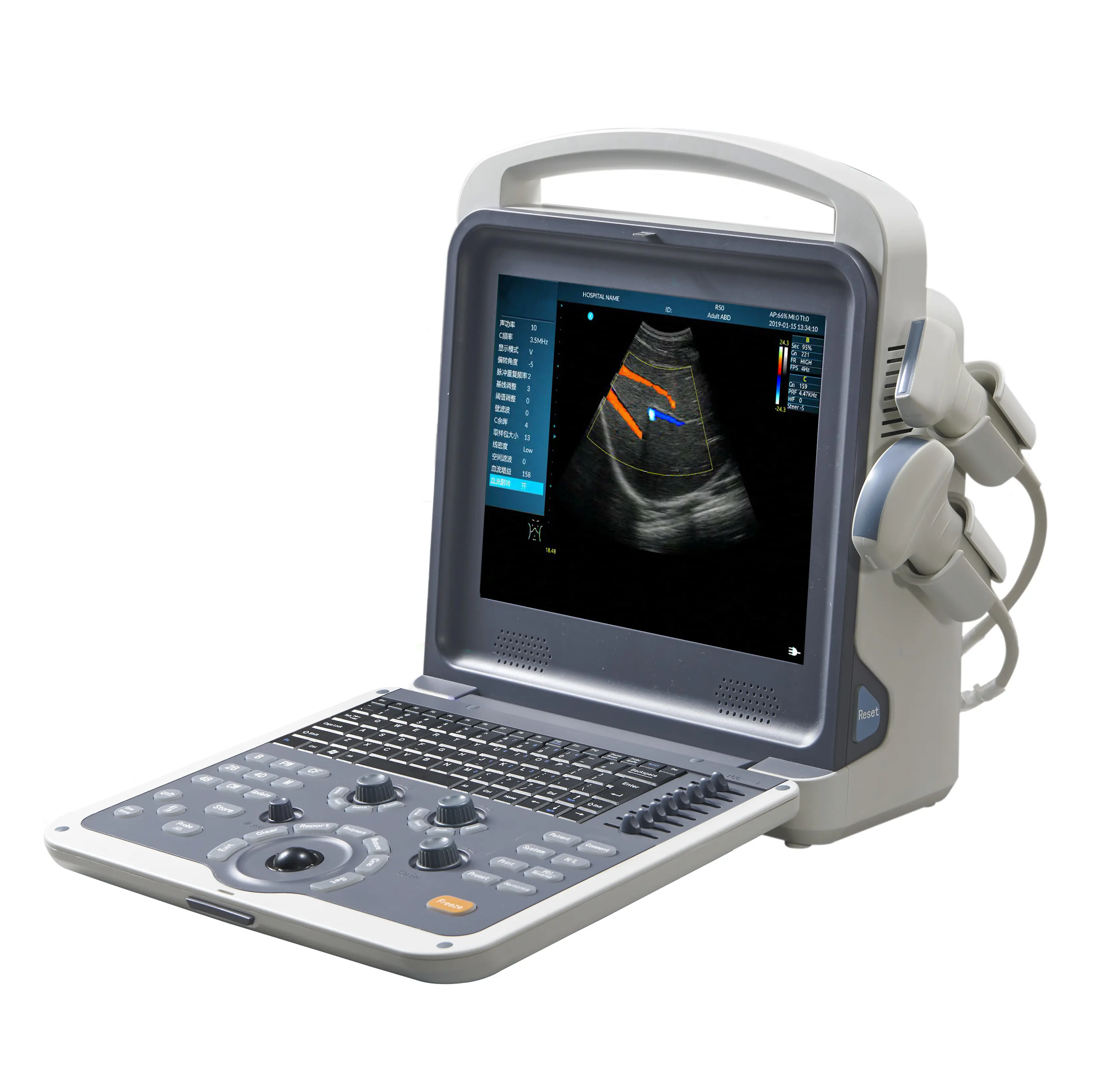 Pemindai Ultrasound ultrasonik, sistem diagnostik ultrasonik Doppler warna Laptop Digital penuh portabel MSLCU62