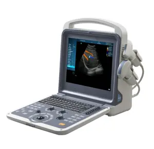 ポータブルフルデジタルラップトップカラードプラー超音波診断システム超音波スキャナーMSLCU62