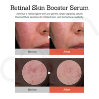Sérum Booster Cutané Luxfume à Marque Blanche au Rétinal, Rétinaldéhyde, Niacinamide et Cica – Hydratant Visage et Corps