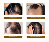 Serum Pertumbuhan Rambut Canggih Label Pribadi Roll-on Alami Mengurangi Kerontokan Rambut Merangsang Pertumbuhan Kembali Memperkuat Akar Serum Rambut Rosemary