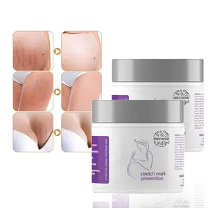 Hautpflege Dehnung streifen Entfernung Creme Lotion Private Label Custom Organic Nou rishing Stretch Mark Cream Set