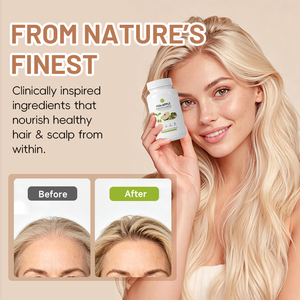 Suplemento Energético Herbal al por Mayor con Biotina de Alta Potencia Contra la Caída del Cabello - Product Image 1