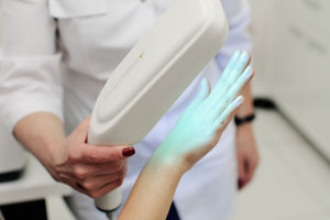 Kernel-Máquina de fototerapia UV para tratamiento de psoriasis y vitiligo, dispositivo excimer LED, UVB, 311nm, para terapia de luz - Product Image 5