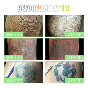 Nouvel arrivage Crème réparatrice de <span class=keywords><strong>tatouage</strong></span> Fixation de la couleur Préservation de la couleur Hydratant et réparateur Verrouillage de la couleur de la peau et anti-propagation - Product Image 4