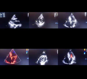 Échographe portable 3D et 4D de cardiologie le plus vendu, de bonne qualité, avec Doppler couleur 4D - Product Image 3