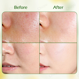 Set naturale per la cura della pelle all'olio d'oliva-idratante, Anti-invecchiamento, lenitivo: <span class=keywords><strong>crema</strong></span>, <span class=keywords><strong>crema</strong></span> per gli occhi, siero, <span class=keywords><strong>crema</strong></span> <span class=keywords><strong>solare</strong></span>, Toner, detergente - Product Image 3