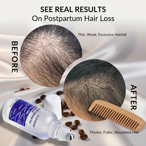 Serum Penumbuh Rambut Pria dengan Redensyl Capixyl Procapil Anagain Kafein Berbasis Air Tidak Berminyak Perawatan Anti-Rambut Rontok - Product Image 5