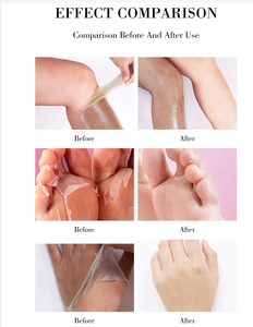 Tiktok-gel de loción Exfoliante para el cuidado de la piel, crema cosmética coreana para el cuerpo, blanqueamiento de nudillos oscuros, elimina la piel muerta, naranja, 2022 - Product Image 6