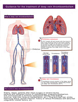 Orthèses Pompe DVT Compression d'air Récupération sportive Dispositif de compression pneumatique Manchon DVT Masseur de jambes