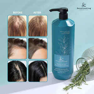 Après-shampoing capillaire biologique à la lavande, marque privée, <span class=keywords><strong>meilleur</strong></span> après-shampoing capillaire biologique à la lavande, anti-chute, fortifiant - Product Image 3