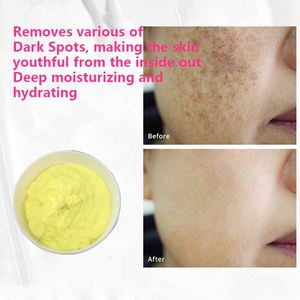Crème éclaircissante pour les taches de rousseur, élimine les taches brunes, atténue le mélasma, réduit la mélanine, améliore l'<span class=keywords><strong>anti</strong></span>-<span class=keywords><strong>pigmentation</strong></span> pour le visage, crème lotion cosmétique - Product Image 2