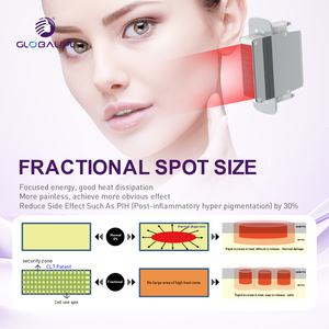 <span class=keywords><strong>Machine</strong></span> de beauté laser 3-en-1 IPL professionnelle pour rajeunissement cutané et épilation indolore, <span class=keywords><strong>prix</strong></span> usine 2026 - Product Image 3
