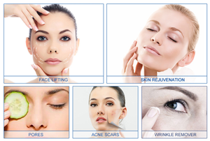 Machine à micro-aiguilles rf la plus populaire serrant la peau machine à micro-aiguilles fractionnaire rf <span class=keywords><strong>prix</strong></span> de vente bas - Product Image 4