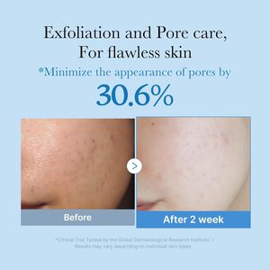 Tonique hydratant exfoliant Medicube Zero Pore personnalisable, flacon bleu, tonique à l'<span class=keywords><strong>eau</strong></span> avec AHA, soin <span class=keywords><strong>de</strong></span> la peau coréen - Product Image 3