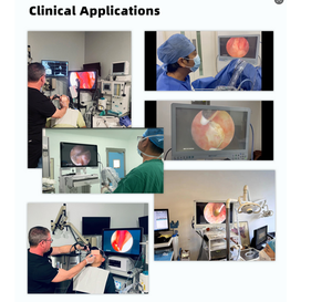 Juego de artroscopia de cistoscopio laparoscópico de 24 pulgadas Cámara endoscópica portátil Full HD 1080P para diagnóstico de cirugía - Product Image 6