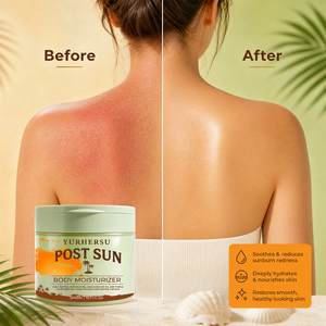Crème hydratante pour le corps après-soleil en gros, au <span class=keywords><strong>beurre</strong></span> de karité, huile de coco et huile d'avocat, nourrissante, non grasse, légère, 300 ml - Product Image 6