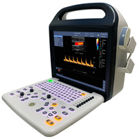 SONOIMAGE P50 Radiant High Definition Veterinary Diagnostic Scanner Approved Class II Medical Equipment for Vascular Imaging