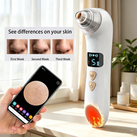 Aspirateur portable pour points noirs avec caméra USB, nettoyeur de pores visuel Wi-Fi 42 ℃   Aspirateur chauffant pour un nettoyage en profondeur des pores du visage